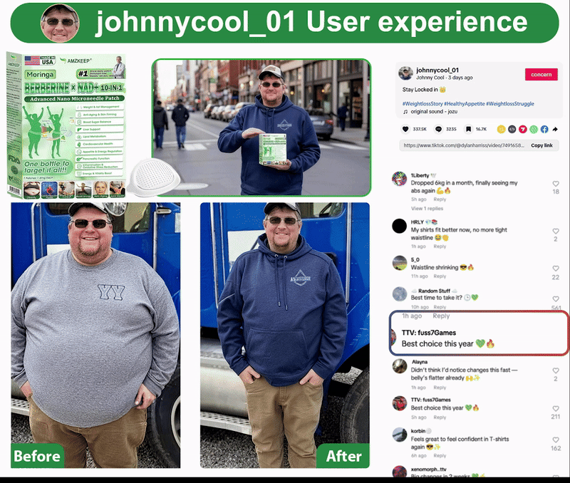 🇺🇸🩺 𝙊𝒇𝒇𝒊𝒄𝒊𝒂𝒍 𝚄𝚂 𝚂𝚝𝚘𝚛𝚎🧑‍⚕️𝙰𝙼𝚉𝙺𝙴𝙴𝙿® 𝙼𝚘𝚛𝚒𝚗𝚐𝚊 · 𝙱𝚎𝚛𝚋𝚎𝚛𝚒𝚗𝚎 × 𝙽𝙰𝙳+ 10-𝚒𝚗-1 𝙽𝚊𝚗𝚘 𝙼𝚒𝚌𝚛𝚘𝚗𝚎𝚎𝚍𝚕𝚎 𝙿𝚊𝚝𝚌𝚑— 𝗢𝗻𝗰𝗲 𝗗𝗮𝗶𝗹𝘆, 𝙑𝙞𝙨𝙞𝙗𝙡𝙚 𝙍𝙚𝙨𝙪𝙡𝙩𝙨 𝗶𝗻 𝟳 𝗗𝗮𝘆𝘀